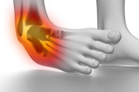 Types of Ankle Sprains