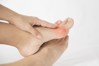 Bunion Surgery May Be Necessary