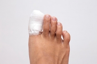 What Causes Broken Toes?